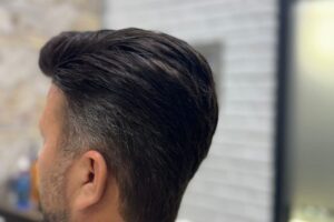 yakın planda protez saç doğal saç çizgisi görünümü