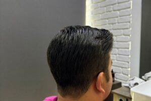 Mersin protez saç uygulaması sırasında doğal görünüm için yapılan profesyonel kesim işlemi