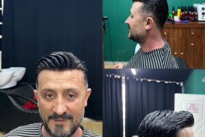 protez saç sadık yalçın mersin doğal görünüm profesyonel uygulama