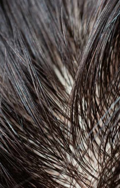 Mersin'de protez saç yaptıran müşterimizin uygulama sonrası ayna karşısındaki doğal ve gür saç görünümü.