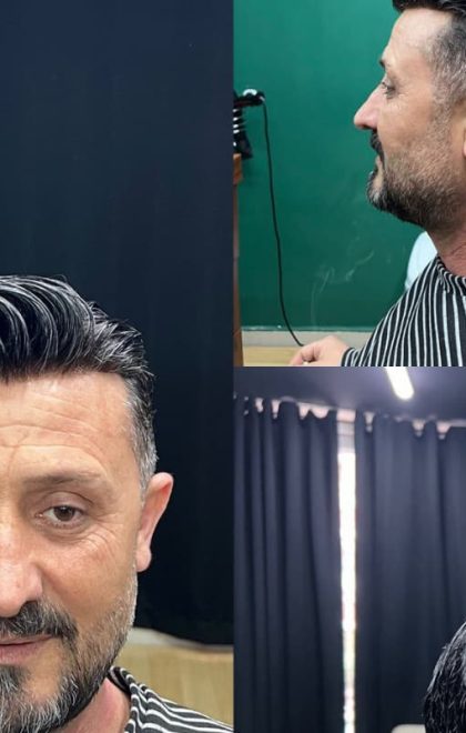 protez saç sadık yalçın mersin doğal görünüm profesyonel uygulama